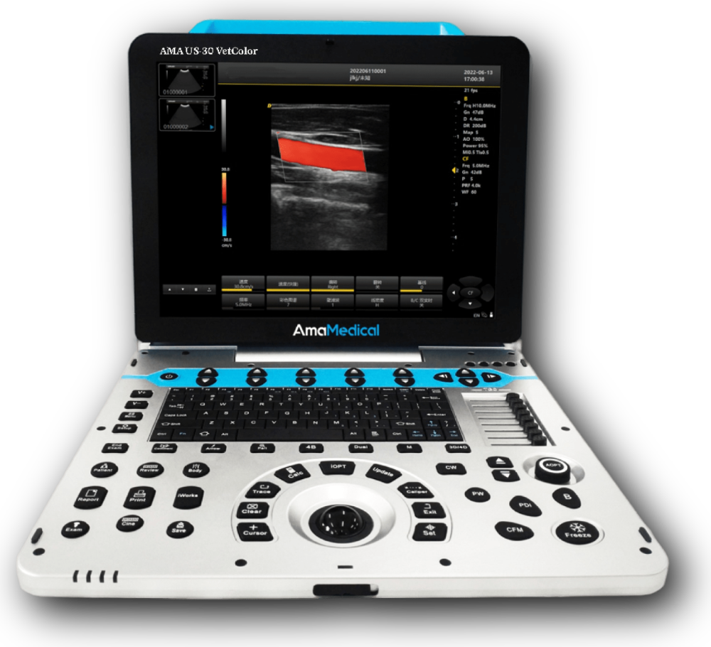 AMA US-30 — Ultrassom Portátil Desktop